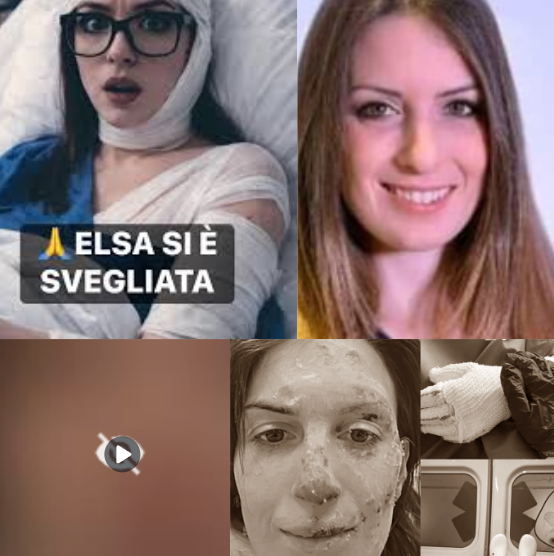 – 29 gennaio 2026 Crans-Montana, Elsa si risveglia dal coma. Le parole di Eleonora: dolore, speranza e la difficile rinascita dopo il buio